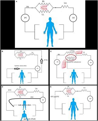 Pulmonary Vascular Resistance Measurement Remains Keystone in Congenital Heart Disease Management